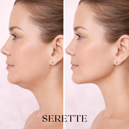 Serette Neck & Face Contour Sculptor™