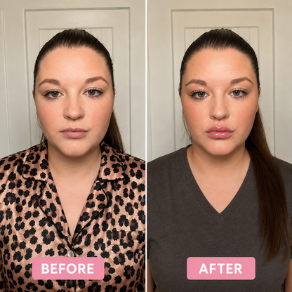 Serette Lip Plump Set™