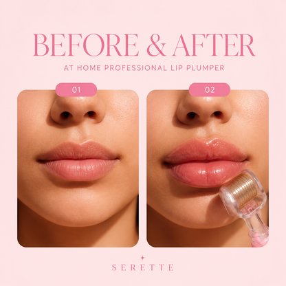 Serette Lip Plump Set™