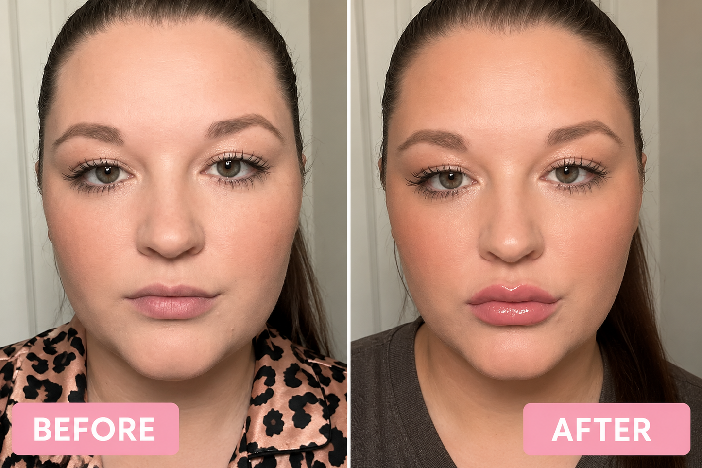 Serette Lip Plump Set™